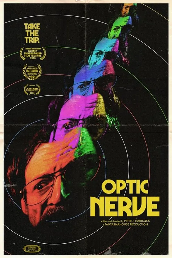 Optic Nerve